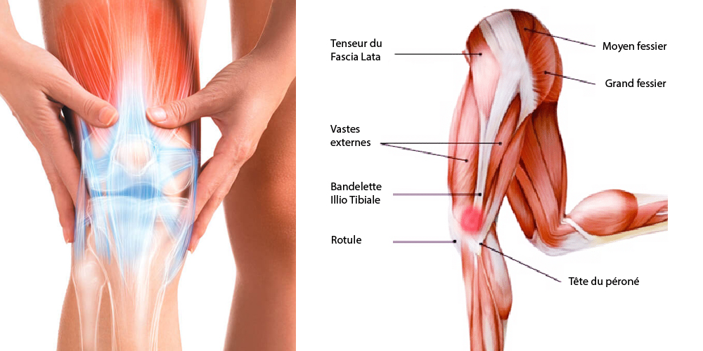 comprendre-le-syndrome-de-l'essuie-galce